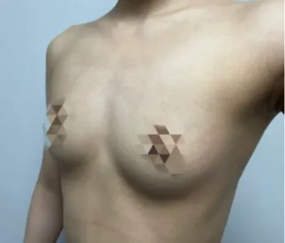 [가슴] 뽀짝이 - 가슴