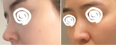 [코] 쿠쿠다쭈 - 코