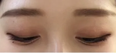 [눈] 생선튀김 - 눈