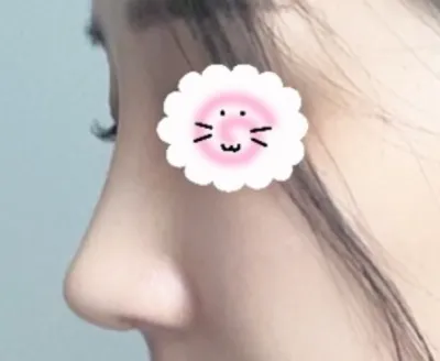 [코] 냥이천국이다 - 코