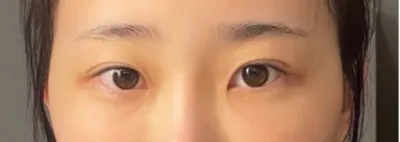 [눈] 풍문으로들었휴 - 눈