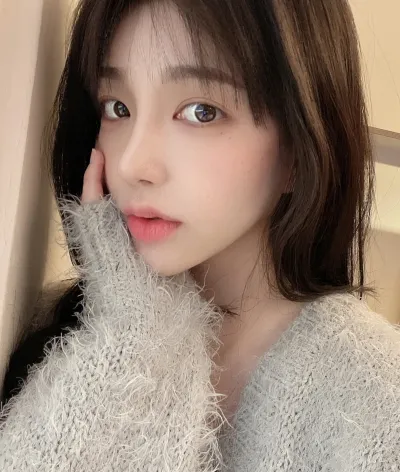 [눈] 맹꽁 - 매몰쌍커풀(재수술), 앞트임, 뒤밑트임