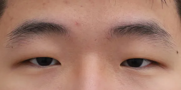 Before