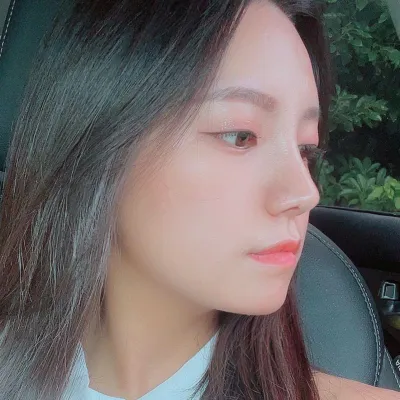 코 수술 두달차 큰 붓기는 다 빠진듯!