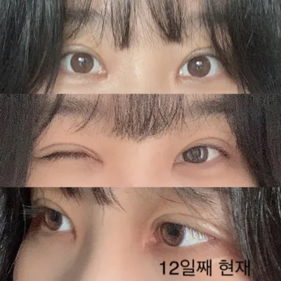 눈 찐만족 찐후기글