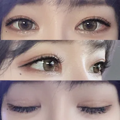 눈 재수술하고 4개월이 지났어요.