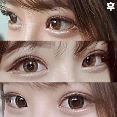 눈 수술한지 3주 됐어영ㅎㅎ