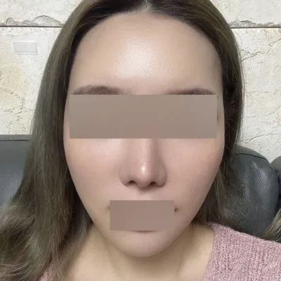 위버스에서 리프팅했어용 완전 맛집