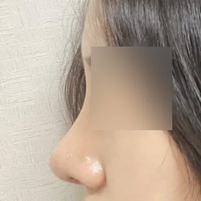 친구 수술했던 곳이라 믿고 했어요ㅎㅎ