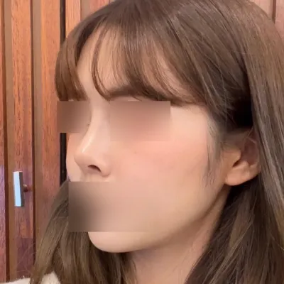 수술하고 주변에서 칭찬 많이 들어요