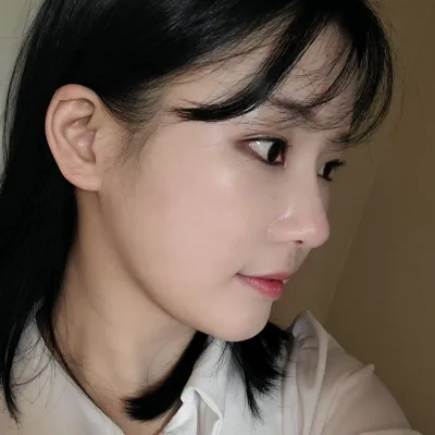 위버스성형외과에서 눈,코재수술한지 벌써 2달 됐어요