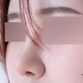 코 고민이라면 너무 추천 드려요~