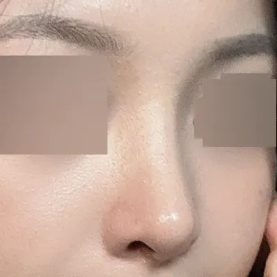 현재 2달차입니다.