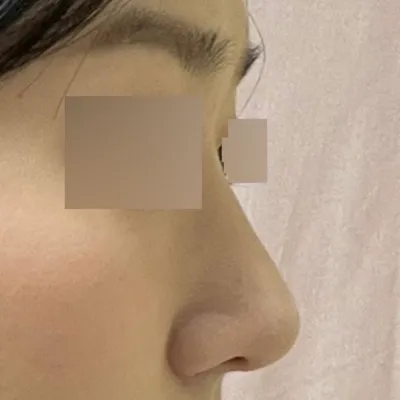 새로운 코 만들어주셔서 아주 맘에 듭니다ㅋㅋ