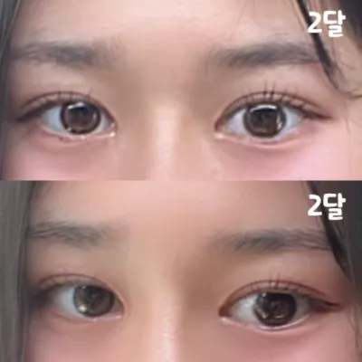 몰라볼 정도로 예쁘게 변했습니다.