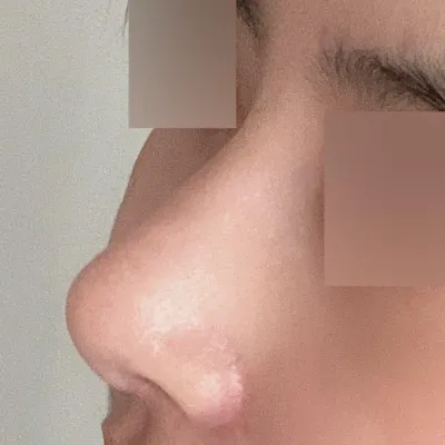 지금은 완전 복코하고 이별한것 같아요 ㅋㅋ