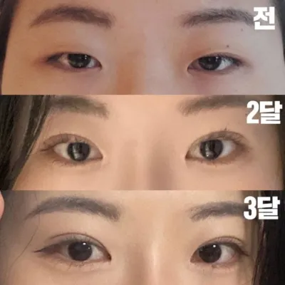 벌써 3개월이 되었는데 정말 자연스러워요