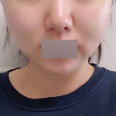 심정환 원장님 손길이 엄청 섬세하신것 같아요