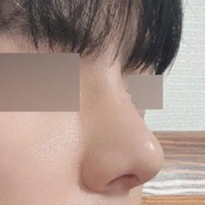 비염 수술겸, 자기 관리겸 수술하게 되었습니다