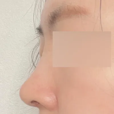 너무 이뻐져서 쌩얼도 자신이 생겼어요