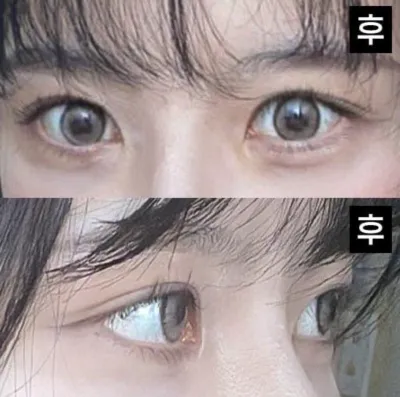 원장님 믿고 맡긴거에 후회없을 정도로 진심 잘한일이라고 생각해요