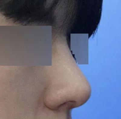 남자는 직선코라고 하는지 이제 이해가 가네요 ㅋㅋㅋ