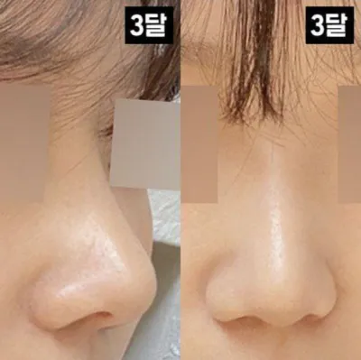 콧대 코끝 다 마음에 들어요!