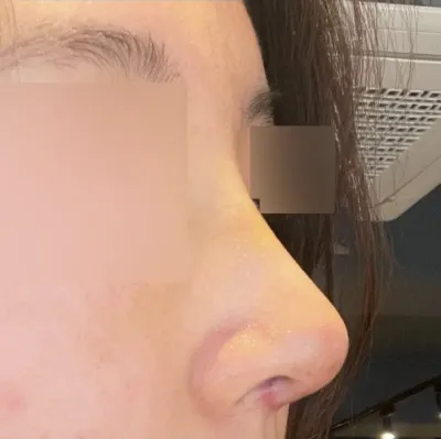 상담도 자세했는데 경과도 엄청 신경써서 봐주셨어요