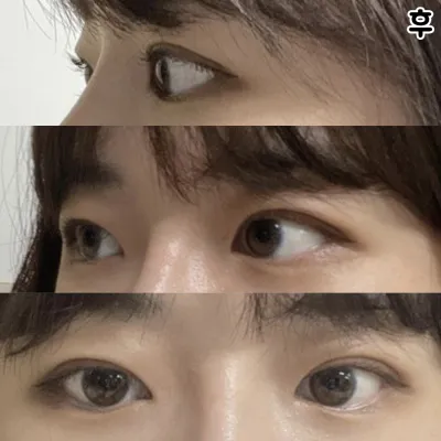 욕심내지말고 원장님께 해야겠다 생각했습니다 ㅎㅎㅎ