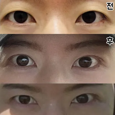 원장님이 잘 만들어주셔서 ㅎㅎ 대만족입니다