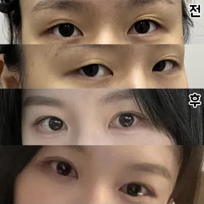 눈에 맞게 라인을 잡아주셔서 더 자연스러운거 같아요