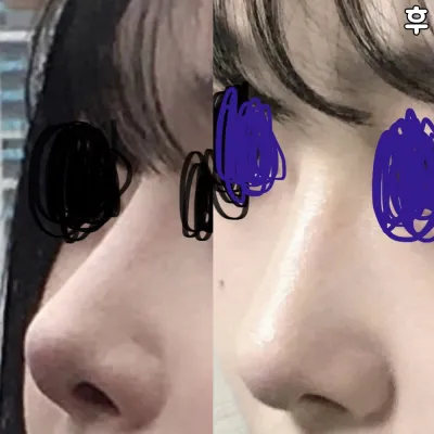 코 너무 이쁘다고 다들 그래요