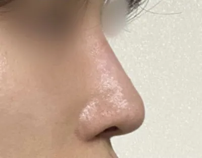 너무 마음에 드는 코를 가져서 기쁩니다!