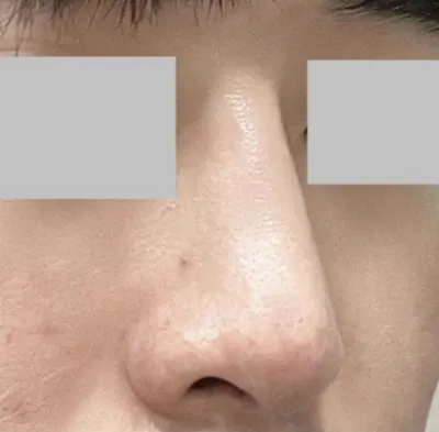 자연스러운걸 원했는데 딱 저랑 맞았던거 같아요