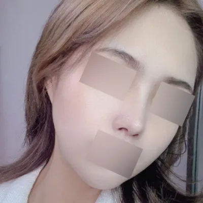 리프팅+코재 4달차 후기에영