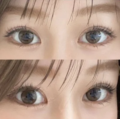 과잉진료 없고 수술하고 나서도 완전 잘 챙겨주셨어요ㅎㅎㅎ