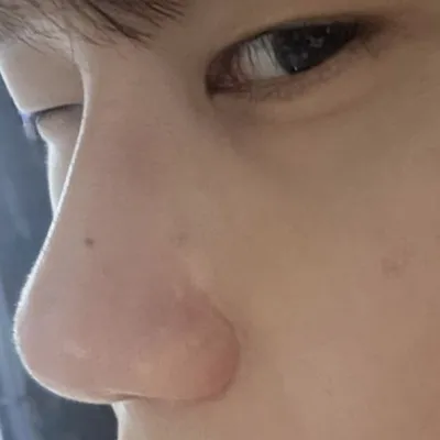 수술하기 잘한 거 같아요 감사합니다