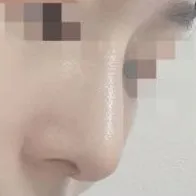 무보형물인데 오연서 코처럼 예쁜 직반라인이 나왔어요!