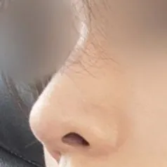 코성형 안한 줄 알았다면서 자연스럽다고 얘기를 많이 해주세요.