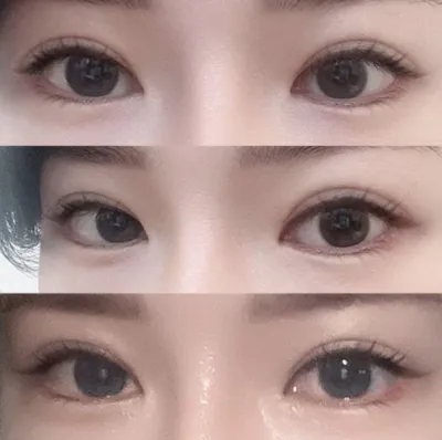 재수술 해야 된다면 다들 위버스 가세요들!! ㅎㅎㅎ