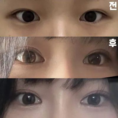 만족스럽게 나와서 너무 행복해요 원장님 감사합니다!!