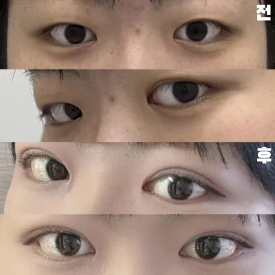 아프지않게 섬세하게 해주셔서 감사했습니다.