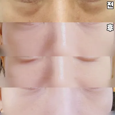 시간 지나면 더 좋아지길 기대하고 있어요.