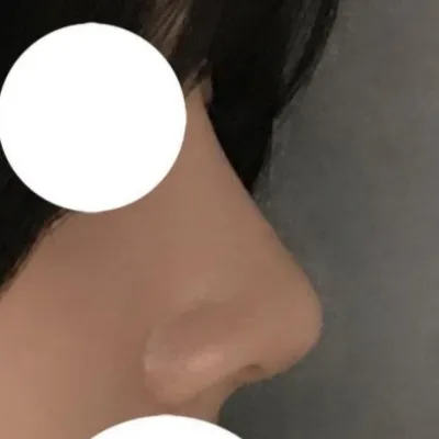 사진 찍을 때도 코 라인이 너무너무 마음에 들어요!