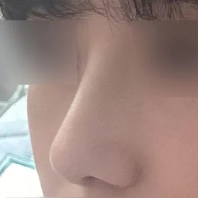 첫 코수술인데도 불구하고 너무너무3728299393829% 만족합니다