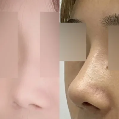 수술 후에 자신감이 생겼어요