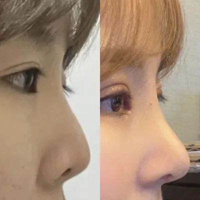 코재수술 서원장님, 눈재수술 심원장님께 했습니다