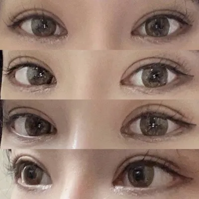 짝눈 교정했어요!