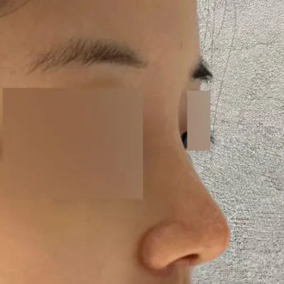 수술한지 벌써 두달째 됐어용