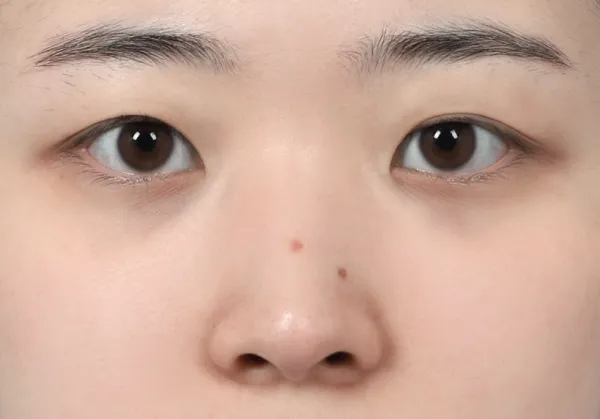 Before